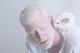 Только ли люди могут быть альбиносами?